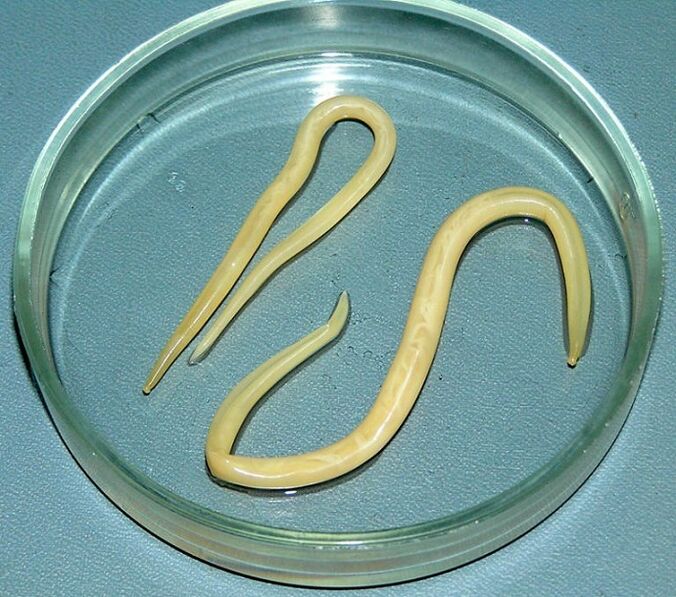 červ parazit z ľudského tela