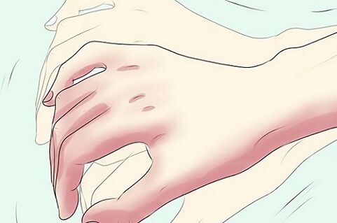 chvenie rúk ako príznak prítomnosti parazitov
