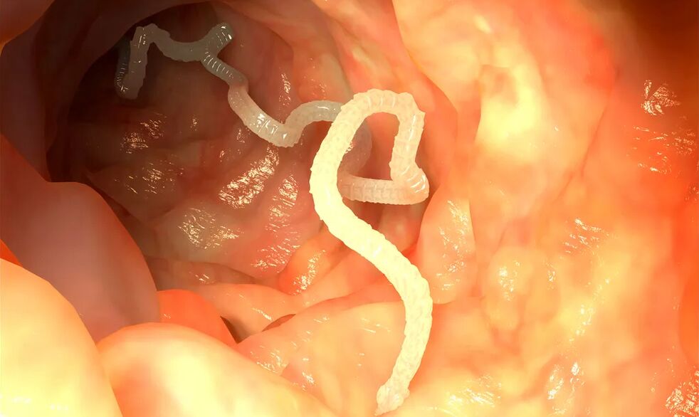 Luminálne červy infikujú črevá