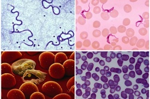 aké môžu byť parazity v ľudskej krvi