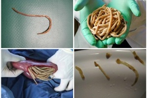aké parazity môžu žiť v ľudskom čreve